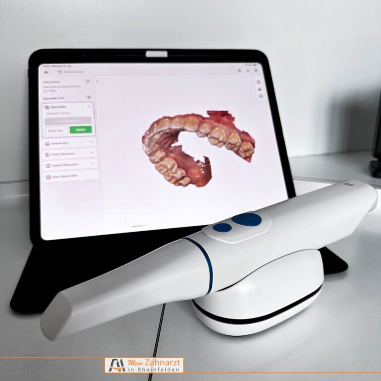 intraoralscanner zahnarztpraxis issa rheinfelden
